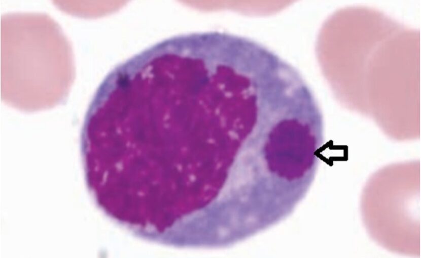 エーリキア症_Ehrlichiosis